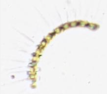Chaetoceros