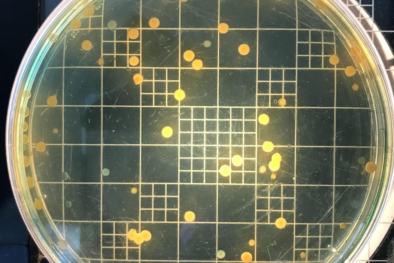 Close of up of vibrio bacteria